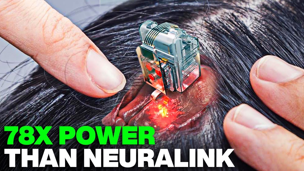 ALL NEW Brain Chip Breakthrough SHOCKS The Entire Industry!